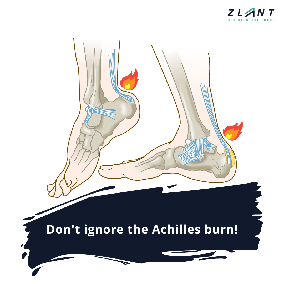 Don't push through Achilles pain!