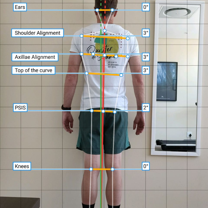 Posture Analysis