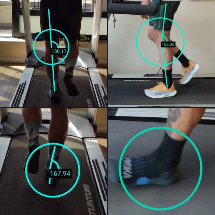 Gait Analysis